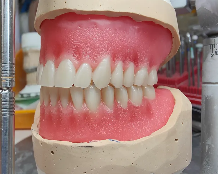 Prothèses dentaires en résine